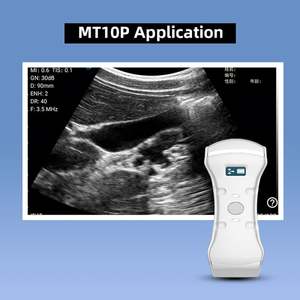 3 in 1 Ultrasound <span class=keywords><strong>Doppler</strong></span> warna Dual Head Convex dan Linear Handheld Ultrasound Probe untuk jantung/arteri/ginjal/HATI/Linux - Product Image 6