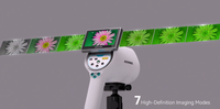 Colposcope vidéo numérique HD Kernel GN-500 5.12MP : la caméra fournit des images cervicales claires et détaillées pour une observation précise
