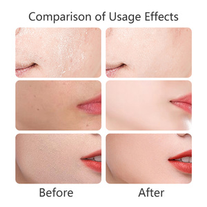 Mascarillas Faciales de Colágeno Orgánico Personalizadas de Fábrica para Hidratación y Humectación, que Proporcionan Alivio Rápido de la Sequedad - Product Image 6