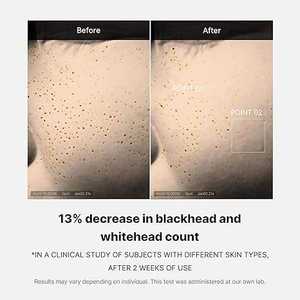 Suero Facial Diario MEDICUBE ZERO PORE ONE DAY de 20g, Suero Coreano Antienvejecimiento para Minimizar los Poros y Exfoliar, Venta al por Mayor - Product Image 3