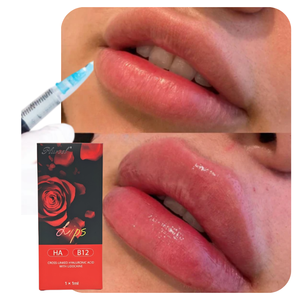 Remplisseur de lèvres rouge en gros sous marque privée 1ml – Repulpe les lèvres, augmente le volume des lèvres, injections liquides BBL - Product Image 2