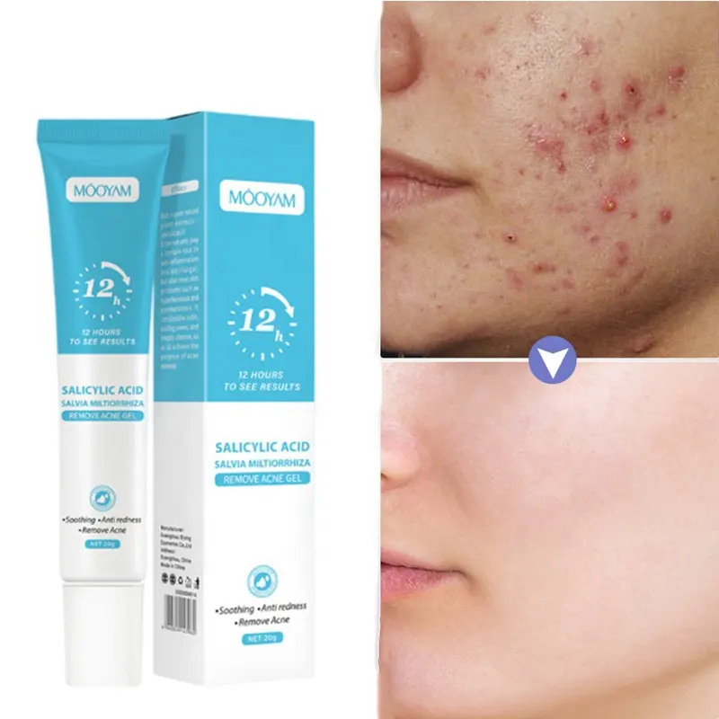 Private label quick anti acne acido salicilico gel viso brufoli cicatrici trattamento gel per la rimozione dell'acne a base di erbe