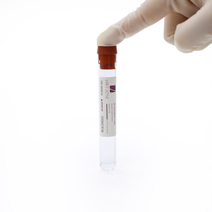 Virtuose révolutionne le traitement de l'arthrite avec l'activateur Tube PRP - Product Image 1