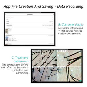 MEIBOYI <span class=keywords><strong>Microscope</strong></span> capillaire numérique à écran tactile de 11.6 pouces, analyseur de follicules pileux à usage domestique, détecteur de peau et dispositif d'analyse de la tête - Product Image 6