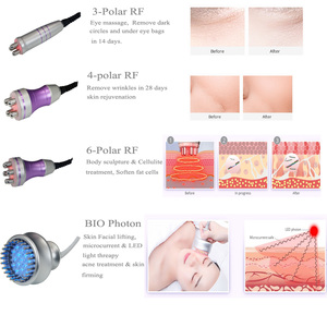 Portable 9 in 1 Multifunctional Face and Neck Lifting Massager Machine - Product Image 5
