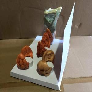 4 orta tiroid ve larinks insan anatomisi tiroid hastalıkları Thyoid sistem modeli tiroid anatomik Model seti - Product Image 4