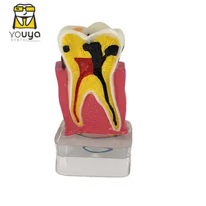 4 مرات شفافة المولي نموذج تشريح بالأعصاب نموذج الأسنان الأسنان