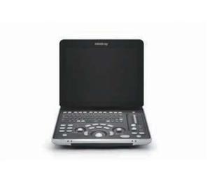 Échographe Doppler Couleur <span class=keywords><strong>Portable</strong></span> 3D/4D Léger Original Mindray Z50 pour Hôpital et Échographie Prénatale - Product Image 6