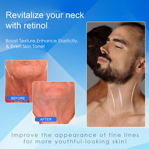 <span class=keywords><strong>Crema</strong></span> para apretar el <span class=keywords><strong>cuello</strong></span> para hombres con logotipo personalizado, <span class=keywords><strong>crema</strong></span> para el <span class=keywords><strong>cuello</strong></span> con retinol reductor de la piel para hombres, <span class=keywords><strong>crema</strong></span> para el <span class=keywords><strong>cuello</strong></span> para reafirmar las arrugas - Product Image 5