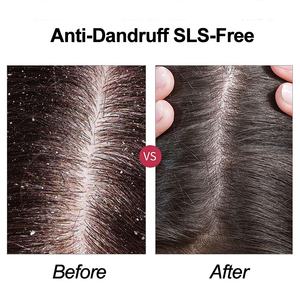 Пантенол анти-истончение биотин питательный шампунь-без перхоти, против перхоти для сухих волос и увлажнения кожи головы - Product Image 2