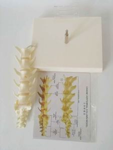 Modelo de vértebras lumbares para perros KyrenMed, modelo de columna vertebral canina de 5 piezas, modelo de columna vertebral de perro para enseñanza de mascotas veterinarias - Product Image 4