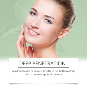 Crema OUHOE para Eliminar Manchas, Melasma, Imperfecciones, Crema Blanqueadora Fuerte para Eliminar Pecas y Corrector Facial - Product Image 5