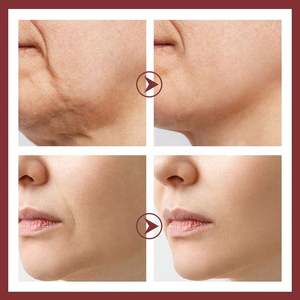 Sérum complexe de peptides anti-âge personnalisé d'usine OEM cosmétiques de vente chaude pour les soins de la peau beauté spa principal niacinamide liquide - Product Image 5