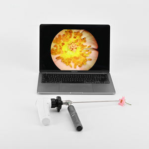 Tıbbi WiFi taşınabilir HD 1080P kablosuz endoskop kamera sistemi ile resim <span class=keywords><strong>Video</strong></span> yakalama ve kbb endoskopi için tasarruf fonksiyonu - Product Image 1