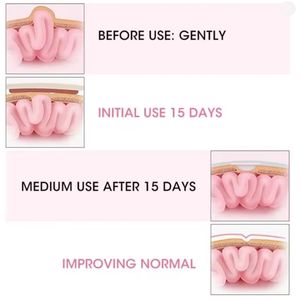 Cinturón de <span class=keywords><strong>hernia</strong></span> umbilical inguinal infantil, algodón de grado médico, <span class=keywords><strong>ozono</strong></span> desinfectado, soporte para el ombligo, pegatinas, tratamiento, vientre de bebé recién nacido - Product Image 6