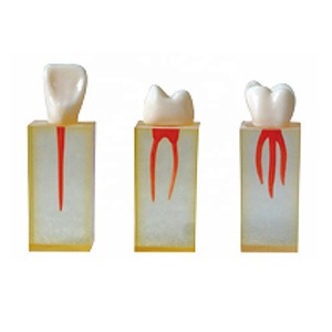 โมเดลฟันสำหรับฝึกฟันคลองรากฟันแบบฝึกฟัน - Product Image 1