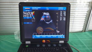 Draagbare VET-laptop 3D PW medische elastografie echografiemachine 15 inch kleuren Doppler sonografie <span class=keywords><strong>USG</strong></span>-apparaat - Product Image 5