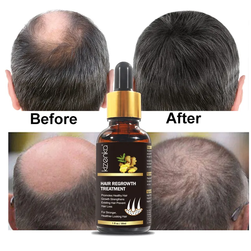 Venta al por mayor Gran oferta 30ml regenerar anti pérdida de cabello aceite de esencia 7 días otoño jengibre germinal rápido crecimiento del cabello suero