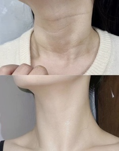 Crema de Suero para el Cuello con Colágeno KXY Smooth Lines, Hidrata, Reafirma y Tensa el Cuello - Product Image 6