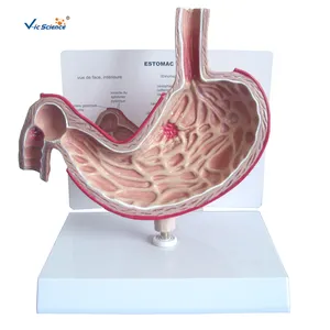 Modèle anatomique humain d'enseignement médical avancé de PVC de vente chaude d'ulcère gastrique
