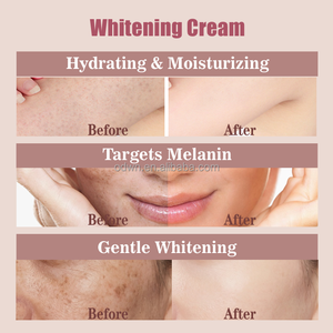 Crema Iluminadora OTVENA Glow Boosting, Reduce las Pecas, Antioxidante, Nutritiva, Suavizante, Producto de Belleza para la Piel - Product Image 4