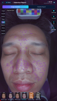 Analyseur de peau IA 8 spectres, scanner facial multi-lumière, imagerie UV polarisée, WiFi, topographie 3D, test cutané UE/US