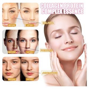 EELHOE 15ml 가수분해된 태반 콜라겐 로즈 오일 단백질 복합 에센스 보습 리프팅 잔주름 제거 페이스 세럼 - Product Image 2