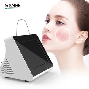 2024 China Home Use 980 Nm Diode Laser Machine Beauty Vascular Capillaries Removal Laser For Spider Vein Blood Vessels Removal