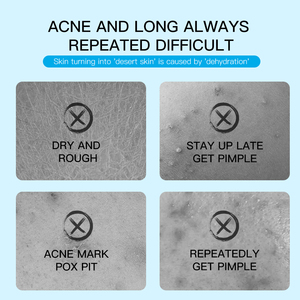 ครีมรักษาสิวสูตรธรรม<span class=keywords><strong>ช</strong></span>าติ DEleventh Private Label สำหรับผู้ใหญ่ วิตา<span class=keywords><strong>ม</strong></span>ินบี5 ไฮยาลูรอนิค แอซิด บำรุงผิวทุกประเภท - Product Image 5