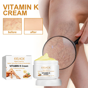 EELHOE Vitamin K <strong>Cream</strong> Glycerin <strong>Varicose</strong> <strong>Veins</strong> Spider <strong>Veins</strong> Bruising Redness Soothing Massage OEM Private Label Wholesale Bulk - Product Image 2