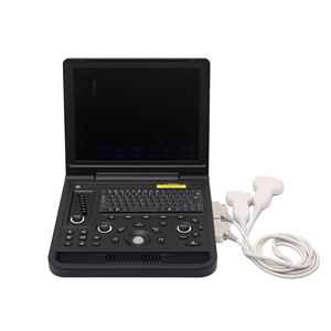 جهاز تصوير بالموجات فوق الصوتية محمول لاسلكي احترافي للتشخيص، جهاز تصوير بالموجات فوق الصوتية محمول بالأبيض والأسود، أجهزة تصوير بيطرية - Product Image 4