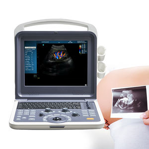 Máquina de ultrasonido portátil, <span class=keywords><strong>Doppler</strong></span> a Color, sistema de diagnóstico por ultrasonido para Obs gyne - Product Image 2