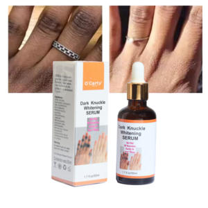 เซรั่มโอคาร์ลี่ ดาร์ค นัคเคิล สำหรับ<span class=keywords><strong>ผิว</strong></span>ขาวใส <span class=keywords><strong>ฉีด</strong></span>บำรุงผิว - Product Image 1