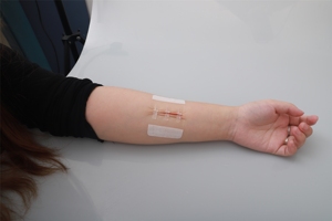 Dispositif de fermeture cutanée jetable pour la réparation des sutures à fermeture rapide - Product Image 4