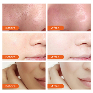 Commercio all'ingrosso Private Label Vegan idratante sbiancante per il viso lavata per la pulizia profonda della pelle schiarente vitamina C detergente per il viso - Product Image 3