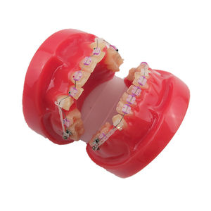Modelo de Demostración de Ortodoncia Dental con 24 Piezas de Brackets de Cerámica - Product Image 4