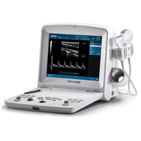 Edan DUS 60 Vet Scanner à ultrasons vétérinaire portable N/B Machine de diagnostic par imagerie pour clinique animale et hôpital