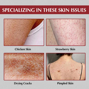 Etiqueta privada fruta natural ácido 20% VCIP niacinamida blanqueamiento brillo hidratante Gel de ducha Perfume lavado corporal máscara <span class=keywords><strong>para</strong></span> <span class=keywords><strong>dormir</strong></span> - Product Image 4