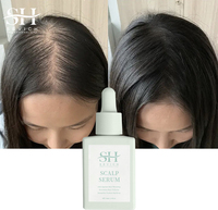 Meilleure vente en gros de l'huile de romarin à base de plantes extrait de menthe poivrée toilettage rapide des cheveux huile de sérum de croissance des cheveux sauvages