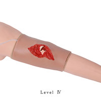 Modèles de fractures orthopédiques en silicone portables pour l'enseignement médical DARHMMY (Différents niveaux de gravité)