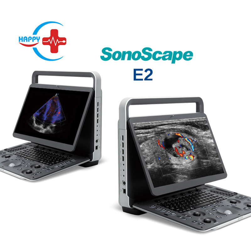 Sonoscape конкурентоспособные ультразвуковые портативные машины Sonoscape E2 E1 E1EXP E3 ecograco sonoscape e2 ультразвуковое устройство