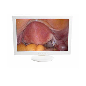 手頃な価格の病院外科用内視鏡装置医療用Hd内視鏡カメラ内視鏡検査ワークステーション列フルセット - Product Image 6