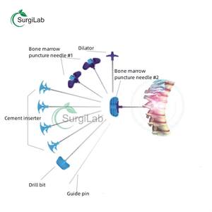 ชุดอุปกรณ์<span class=keywords><strong>ฉีด</strong></span><span class=keywords><strong>ซีเมนต์</strong></span><span class=keywords><strong>กระดูก</strong></span>แบบใช้ครั้งเดียวสำหรับการผ่าตัดกระดูกสันหลังผ่านผิวหนัง (PVP) สำหรับภาวะ<span class=keywords><strong>กระดูก</strong></span>สันหลังแตกจากแรงกด - Product Image 3