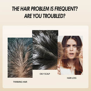 Suero de Aceite Natural de Romero y Cebolla Anticaída, Nutre los Folículos y Estimula el Crecimiento del Cabello, 30 ml, Apto para Cabello Fino - Product Image 6