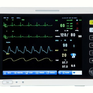 เครื่องมอนิเตอร์สัตว์เลี้ยงแบบพกพาหน้าจอสัมผัส OEM ขนาด 305x162x290 มม. อุปกรณ์ตรวจสอบสัตว์เลี้ยงหลายพารามิเตอร์สำหรับสุนัขและแมว - Product Image 5