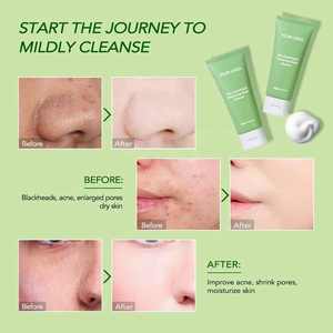 Tùy Chỉnh OEM Sữa Rửa Mặt Cho Nam Giới Và Phụ Nữ, Làm Sạch Sâu Thu Hẹp Lỗ Chân Lông Giữ Ẩm Và Giữ Ẩm Rửa Mặt - Product Image 5