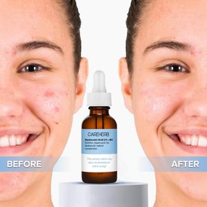 Custom Intense Hydration Moisture <b>Brightening</b> Anti Aging Wrinkle Reducing Hyaluronic Acid <b>Serum</b> for Face - Product Image 1