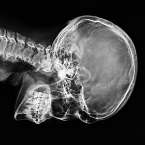 Edical-edical de 17x14 pulgadas, aparato electrónico de radiocontrol de 17x14 pulgadas, silencioso - Product Image 6