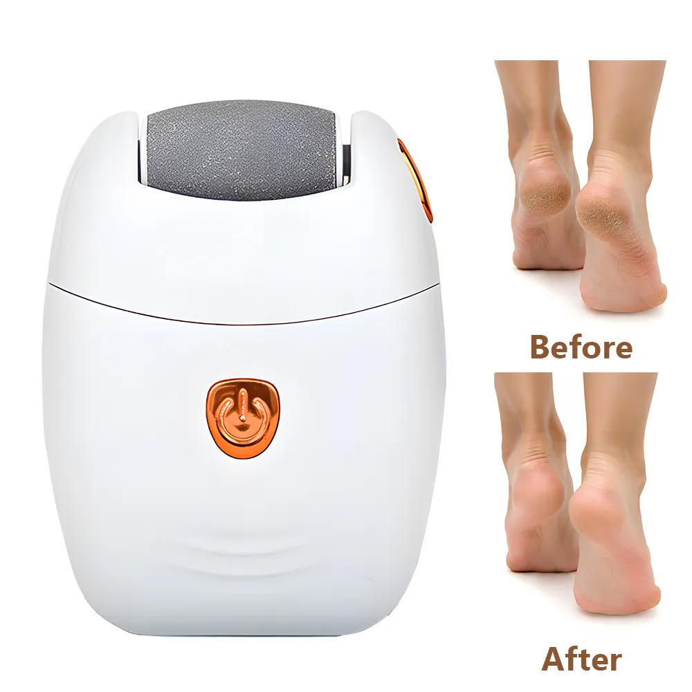 مبرد قدم صغير محمول قابل لإعادة الشحن مبرد كهربائي للمساعدة على التخلص من الجلد الميت مزود بمصباح إضاءة ليد