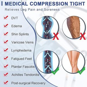 Chất Lượng Hàng Đầu 20-30mmHg Đầu Gối Cao Tùy Chỉnh Médical Nén Vớ Thời Trang Tốt Nghiệp Mở Ngón Chân Nén Vớ - Product Image 6